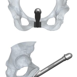 تصویرپروتز آلت ترانس سکشوال فالوپالستی ZSI100FTM