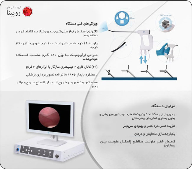 هیستروسکوپ فلکسیبل یکبار مصرف Disposable Electronic Hysterscope 1 دستگاه Disposable Electronic Hysterscope